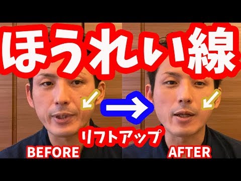 【初公開】ほうれい線・リフトアップに効く「側頭筋リリース」【大分市 腰痛治療家 GENRYU ( 安部元隆 )】Reduce the laugh lines with GENRYU&#039;s METHOD