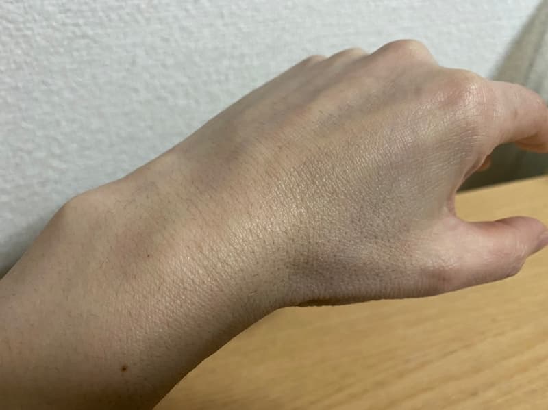 多毛症対策：親指の付け根＆手の甲 ムダ毛処理