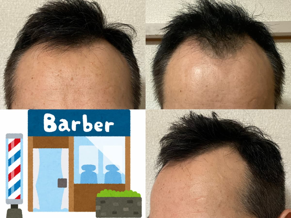 50代男-AGA治療中 QBハウス散髪頻度1ヶ月→3週間へ短縮した話です！