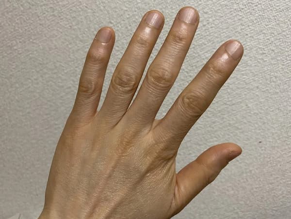 爪の状態-写真2